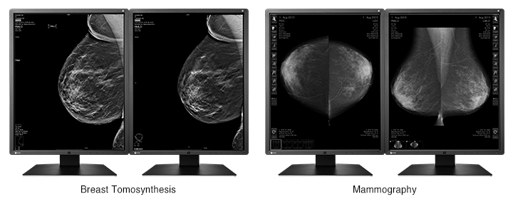 digital tomosynthesis fda digital tomosynthesis fda