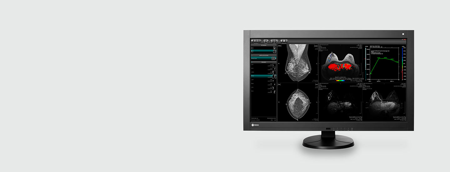 Color Mammography Monitor - Radiforce RX850