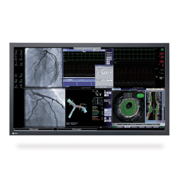 Hybrid Display Monitor