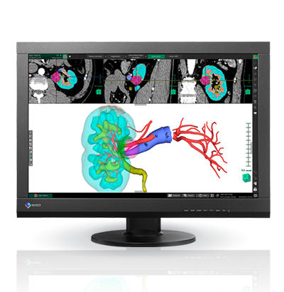 Clinical Review: Superior Cost Performance for Viewing Patient Charts with Medical Images