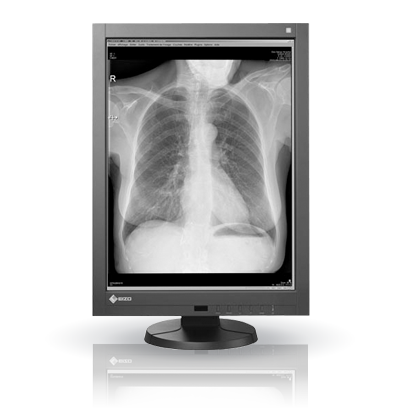 Diagnostic Displays – PACS: Exceptionally Accurate and Stable Image Display