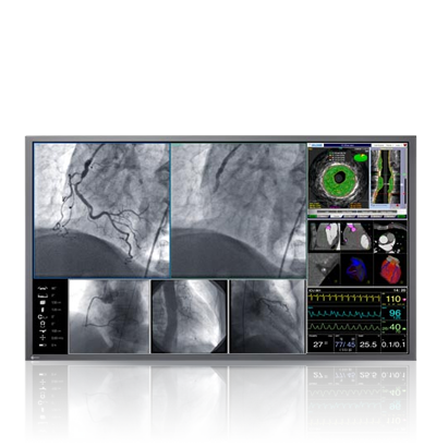 Surgery & Endoscopies: High-speed imaging for endoscopy, surgery, cardiac imaging and ultrasound